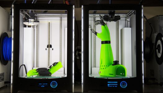 “Researchers from across the University of Nebraska system will spend the next two years designing and testing a new 3D-printed arm designed to improve the lives of children with lower arm amputations and medical malformations.”