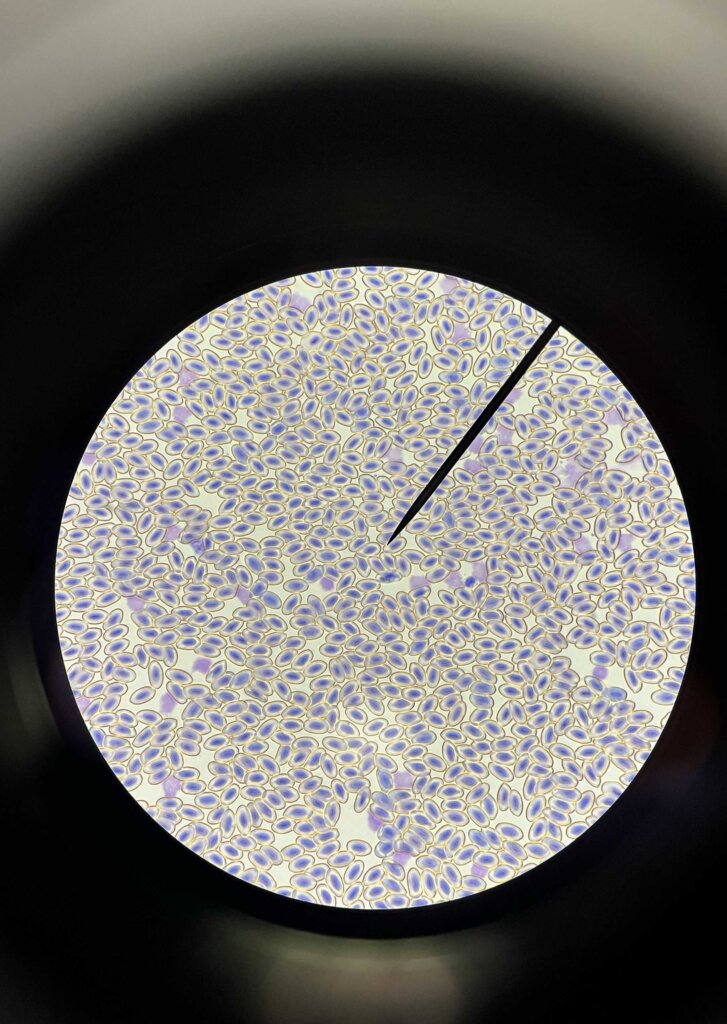 A view through the microscope.
